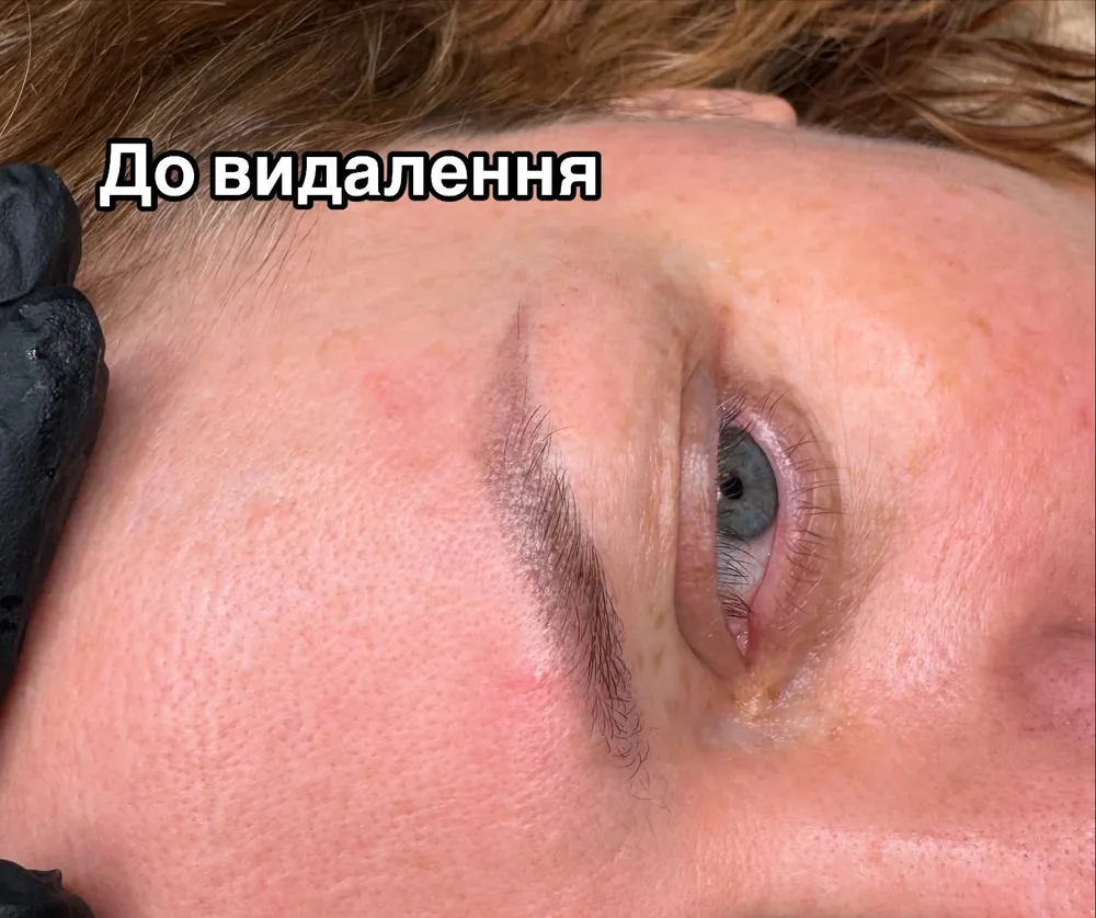 Оригінальне архівне фото брови з написом «До видалення».